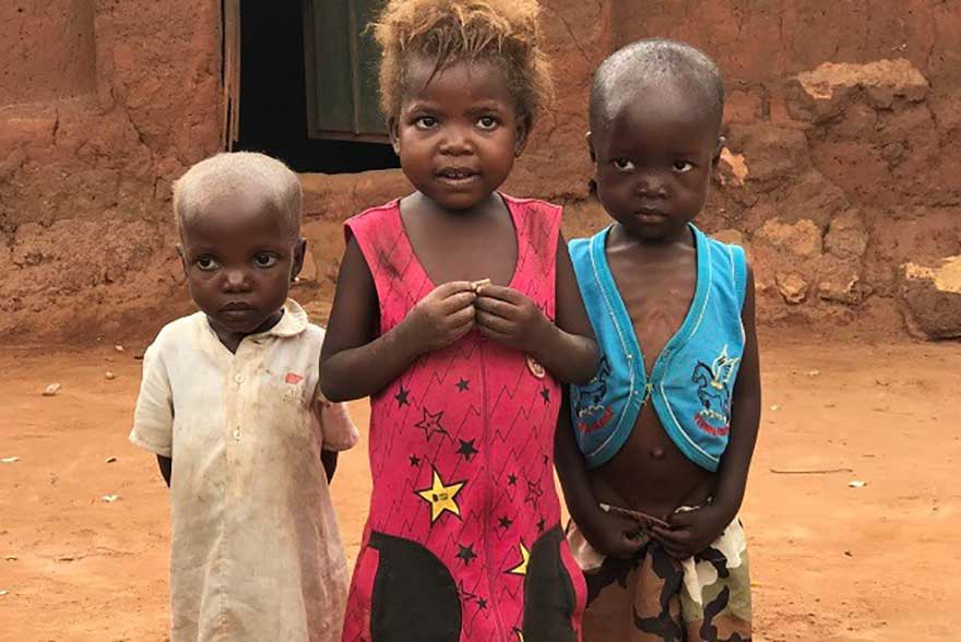 Desnutrición en R. D. Congo