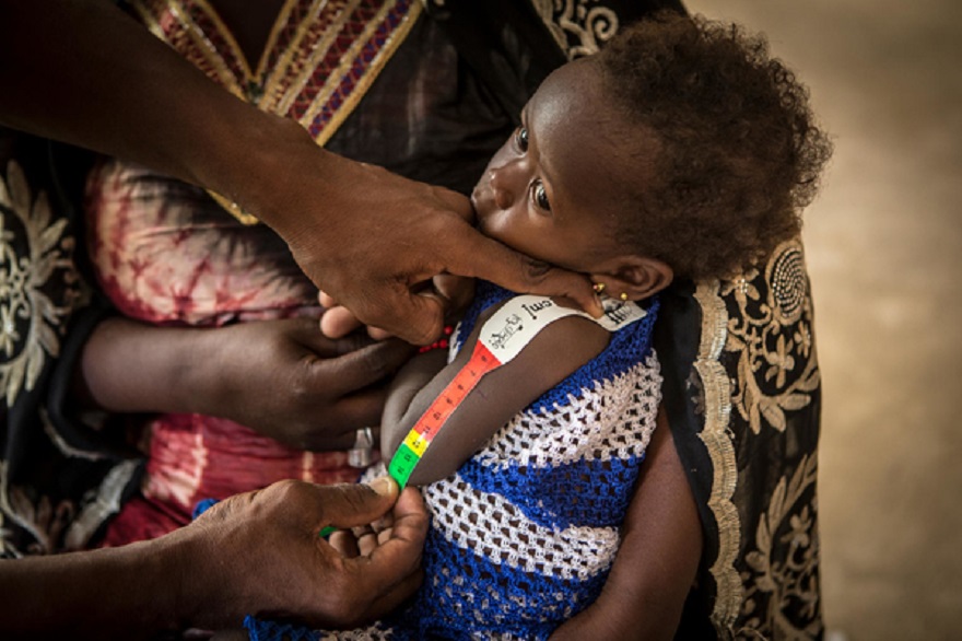 Mali.Desnutricion