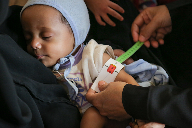 Los niños de Yemen necesitan la ayuda de UNICEF