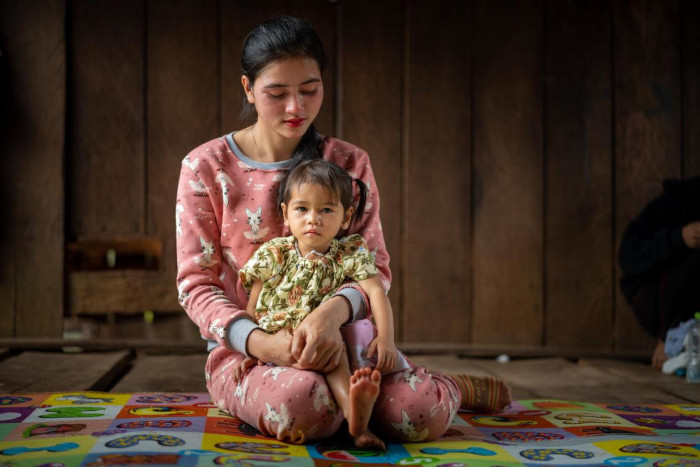 Una niña que sufre desnutrición aguda en Camboya.