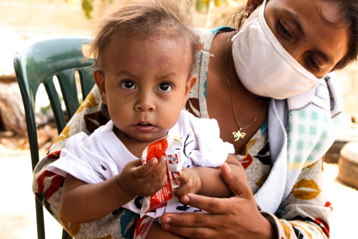 Un niño recibe el alimento terapéutico listo para usar en Venezuela.