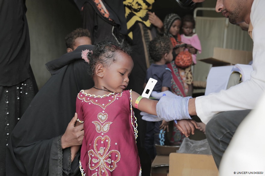 Yemen: La desnutrición aguda amenaza a la mitad de los niños menores de cinco años en 2021