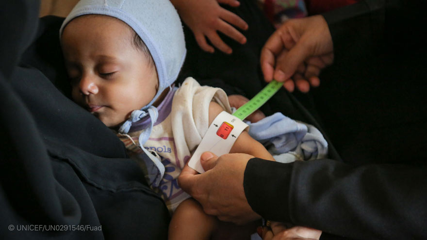 10,4 millones de niños en la República Democrática del Congo, el noreste de Nigeria, Sahel Central, Sudán del Sur y Yemen sufrirán desnutrición aguda en 2021