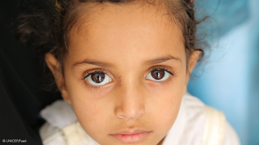 Yemen cólera 2017