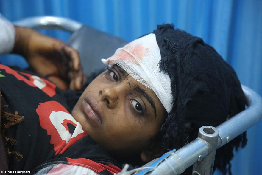Ataque a un bus escolar en Yemen