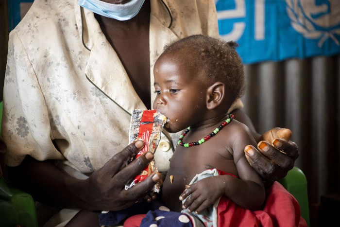 Tratamiento contra la desnutrición infantil: alimento terapéutico.