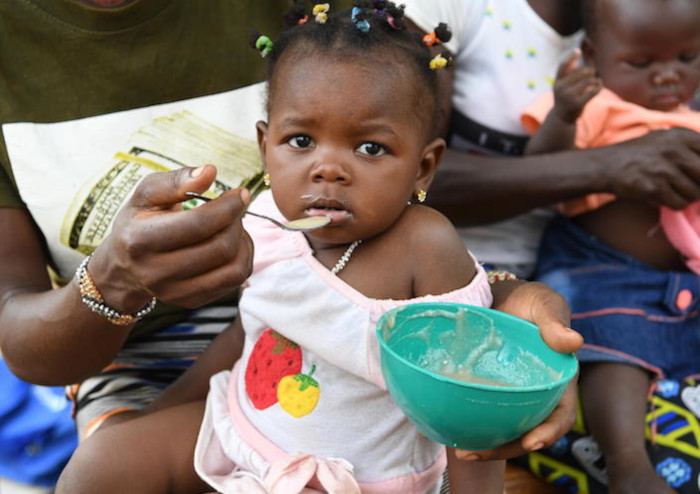 Una niña recibe tratamiento contra la desnutrición.
