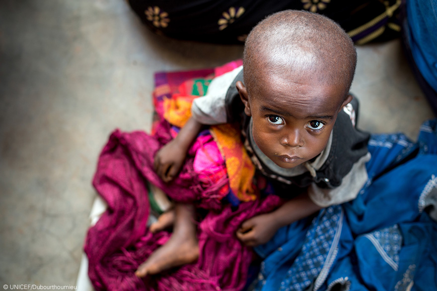República Democrática del Congo: 400.000 niños podrían morir por desnutrición