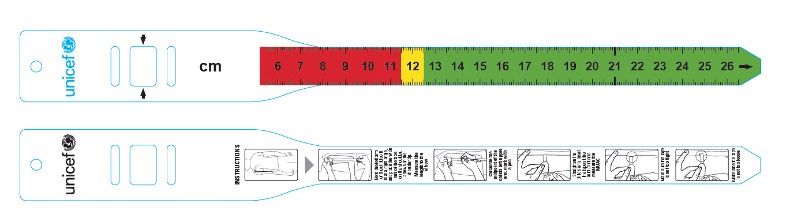 diagnóstico de la desnutrición infantil