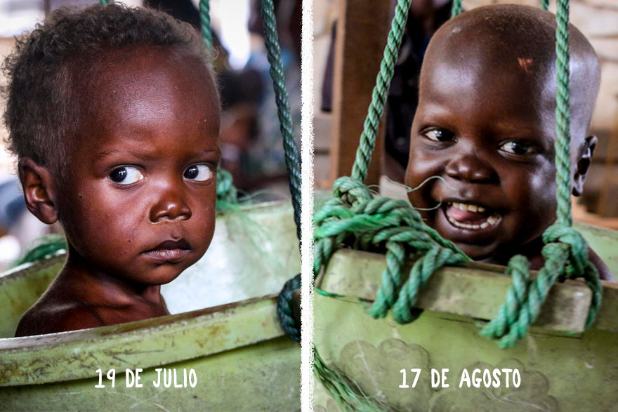 Pierre en el peso del centro de salud antes y después de recibir tratamiento contra la desnutrición aguda grave