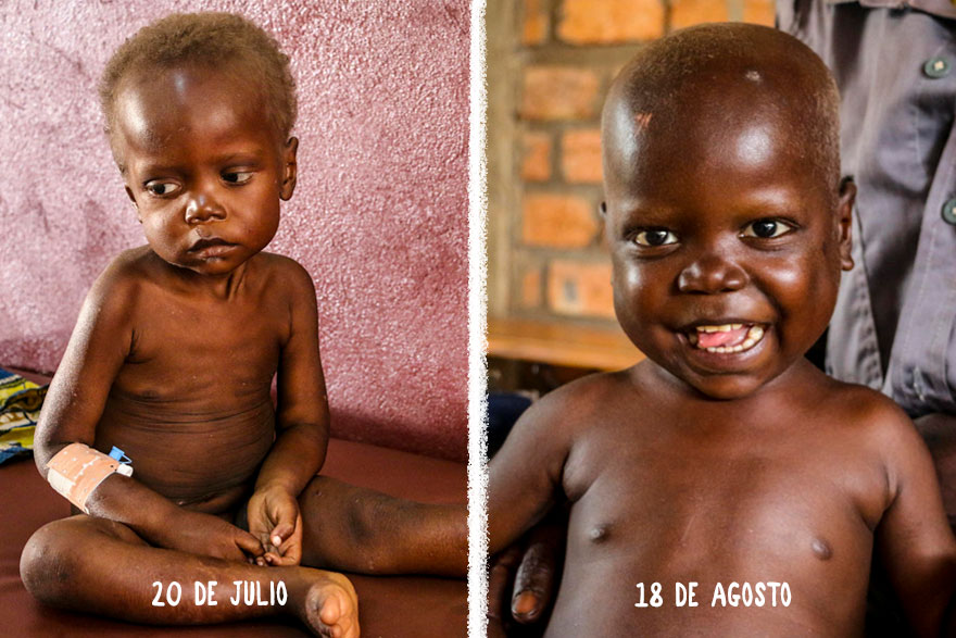 Esta es la prueba de que la desnutrición se puede superar