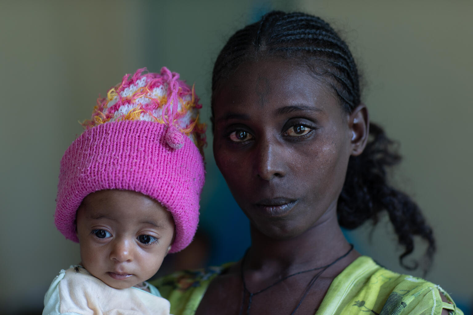 Una madre y su bebé con desnutrición en Tigray, Etiopía