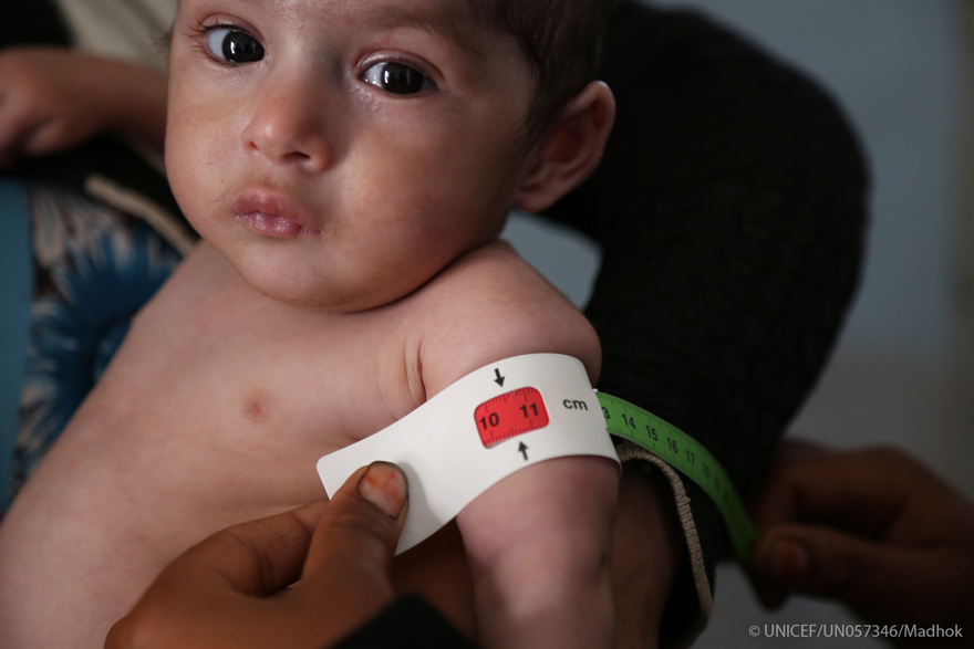 UNICEF visita Yemen