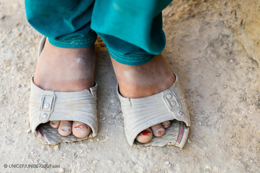 Una niña muestra sus viejos zapatos rotos en Afganistán