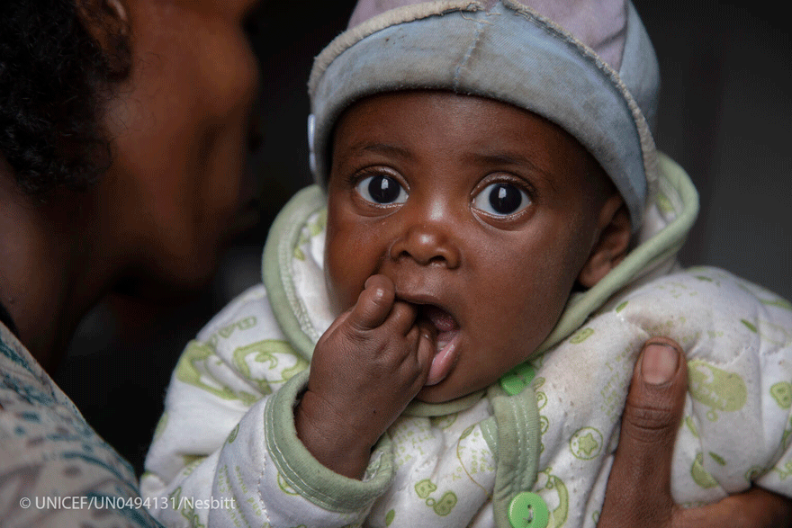 Se multiplica por diez el número de niños que necesitan tratamiento para la desnutrición aguda en Tigray 