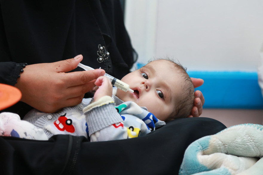 Un bebé en un centro de tratamiento contra la desnutrición en Yemen.