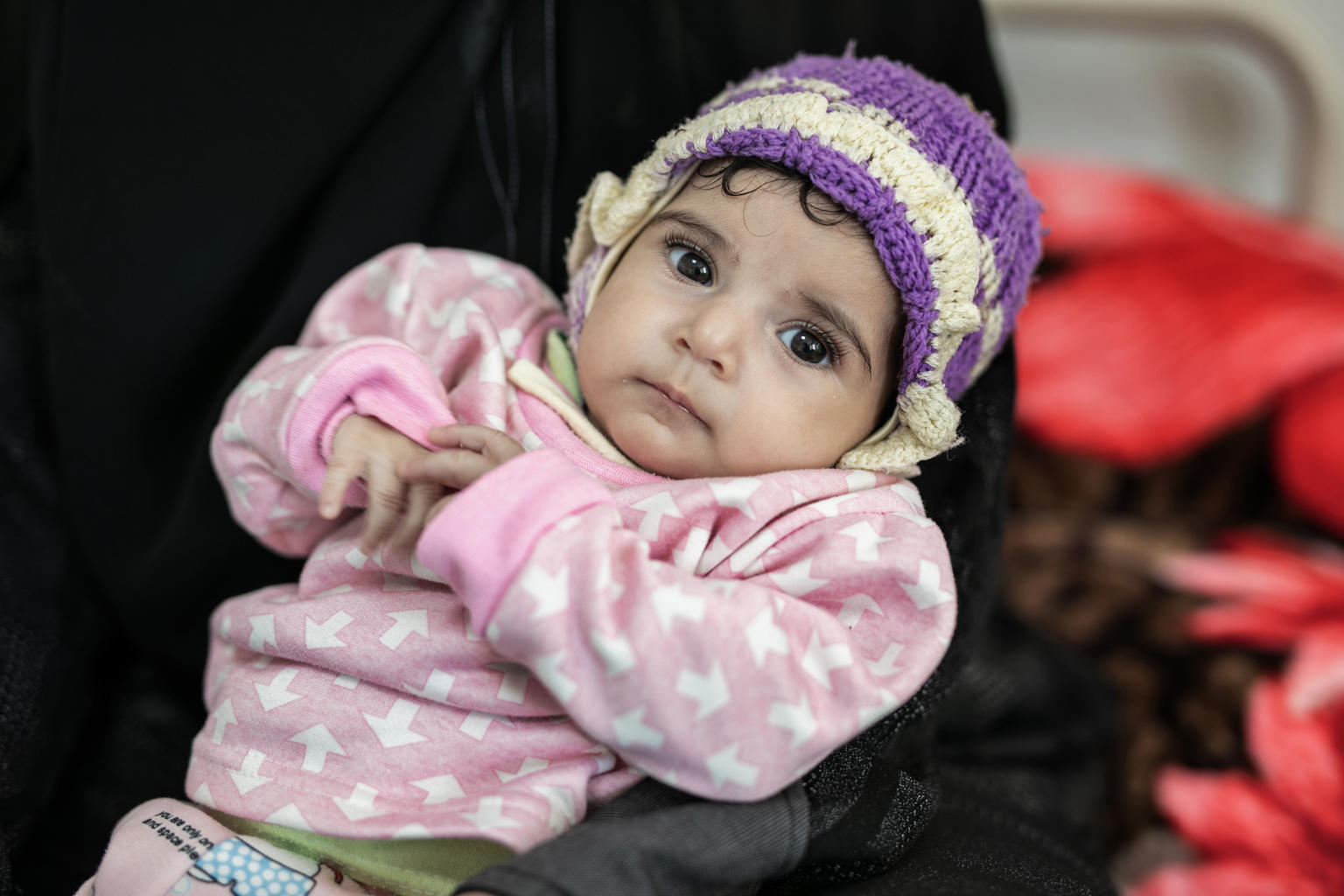 Yemen niños desnutricion aguda grave 2021