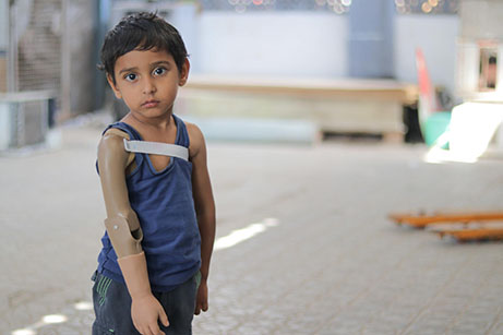 Yemen: millones de niños en riesgo y el país al borde de la hambruna