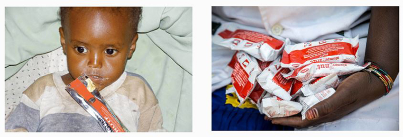 Zakariya se ha recuperado gracias a UNICEF
