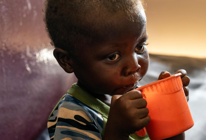 Un niño con desnutrición en República Centroafricana bebe leche fortificada.