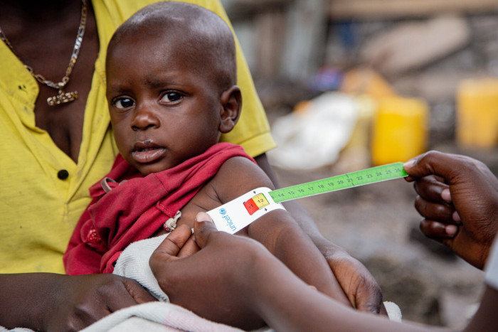 La desnutrición aumenta en las regiones más frágiles del mundo