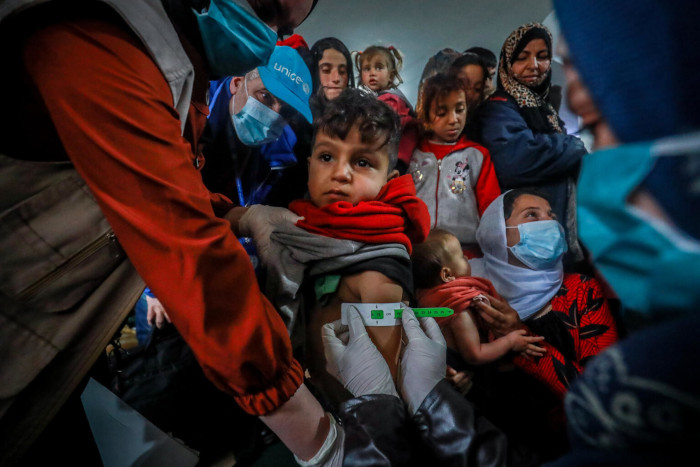 Un niño en un control de nutrición en Siria.