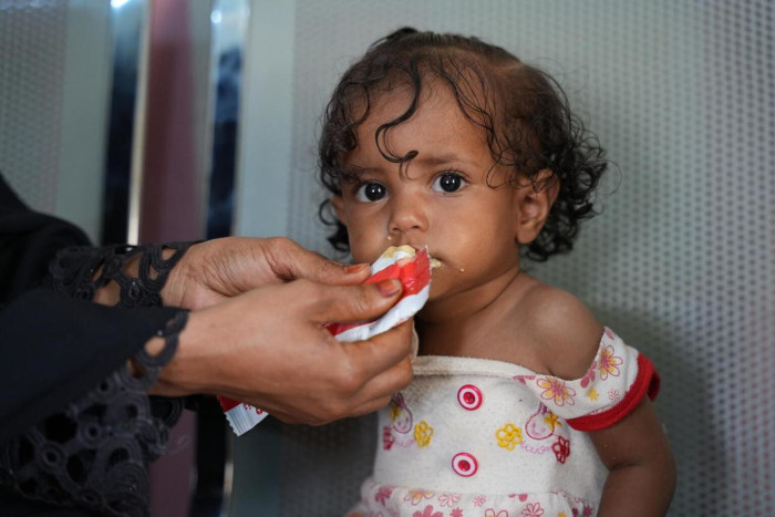 En Yemen, la desnutrición marca la vida de muchos niños