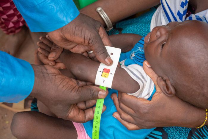 Hassan, de 18 meses, en un control de su estado nutricional en Burkina Faso.