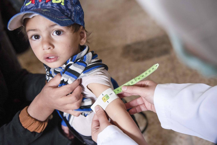 Ishak en un control para detectar la desnutrición aguda.