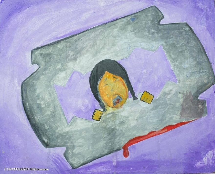 Mutilación genital femenina
