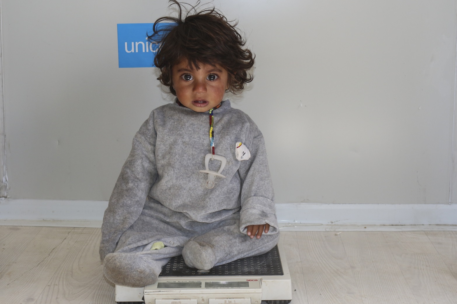 Un bebé es sometido a un examen nutricional en Siria