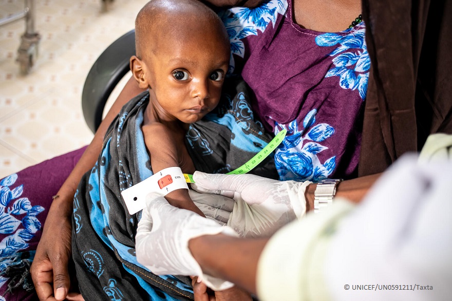Medición de la circunferencia del brazo de un niño somalí