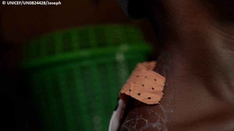 Hombro de una niña haitiana herida a causa de la violencia en su país