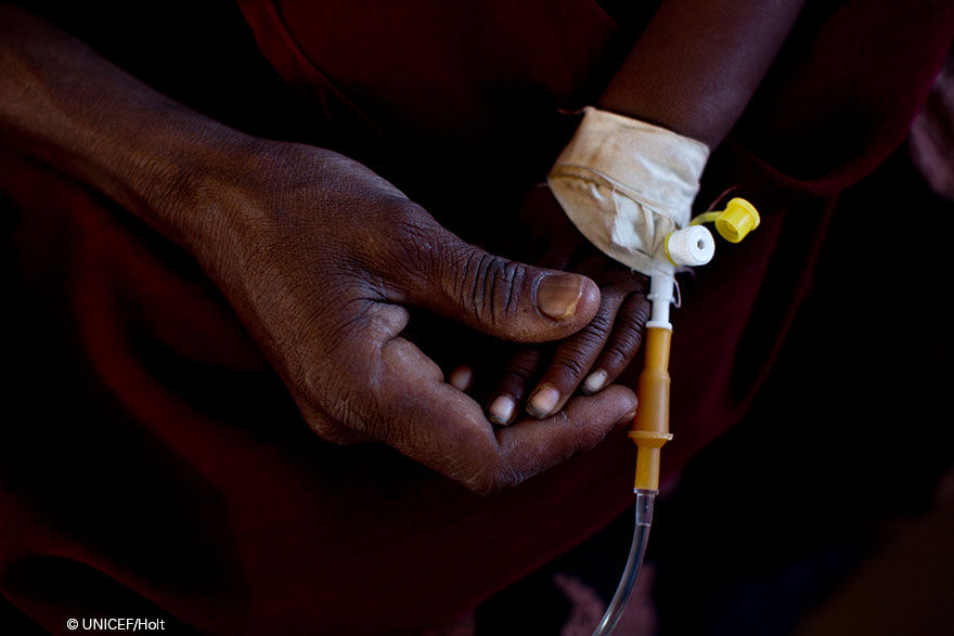 La desnutrición infantil se dispara en Somalia