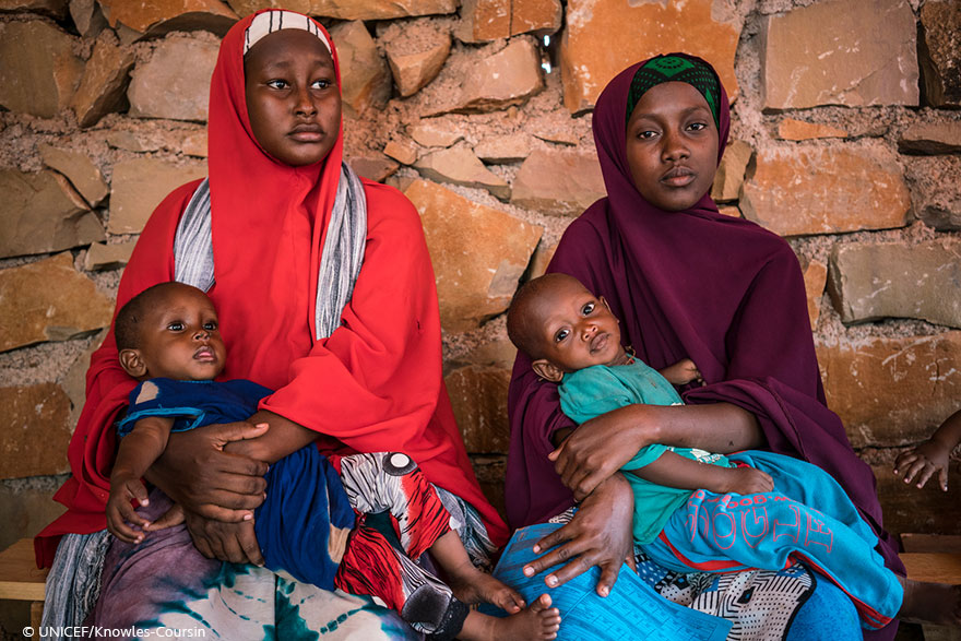 Somalia: el número estimado de niños con desnutrición aguda en Somalia crece un 50 %