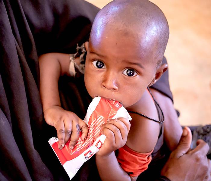 Alerta por hambre: El tiempo se acaba. Ayúdalos. Un bebé come alimento terapéutico.