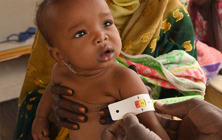 Pesan y miden a un bebé en el hospital de Moussoro, en el este de Chad. Un bebé siendo pesado y medido