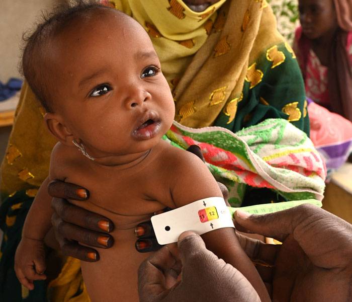 Pesan y miden a un bebé en el hospital de Moussoro, en el este de Chad. Un bebé siendo pesado y medido