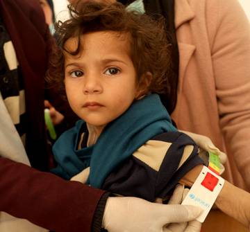 Leen, de 2 años, en un control de su estado nutricional: padece desnutrición aguda grave, como se puede ver en la franja roja de la cinta que mide la circunferencia superior de su brazo. Leen, de 2 años, en un control de su estado nutricional: padece desnutrición aguda grave, como se puede ver en la franja roja de la cinta que mide la circunferencia superior de su brazo.