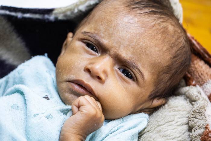 Un bebé en Yemen